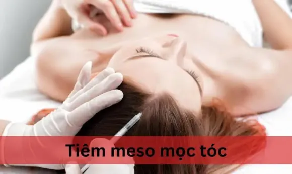 Messo mọc tóc: Liệu pháp phục hồi mái tóc thưa yếu, gãy rụng hiệu quả